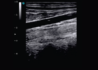 Aorta Caninca, modo B sonoeye P2