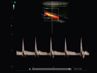 Vaso Abdominal canino, modo pw sonoeye P2