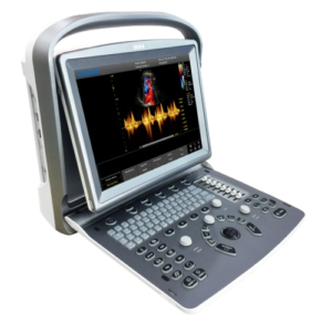 ultrassom-veterinario-eco-6-chison-removebg-preview
