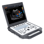 ultrassom g30